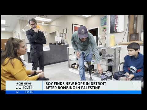Hope and Healing: Gaza Boy Brought to Detroit for Prosthetic after surviving Bombing in Palestine