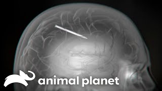 A Man Has A Whole Nail Stuck In His Brain! | Monsters Inside Me | Animal Planet
