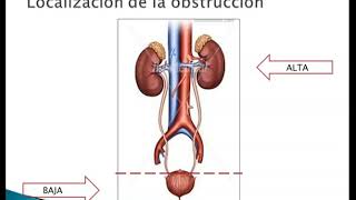 Obstrucción del tracto urinario (Dra. Ana Guerisoli)