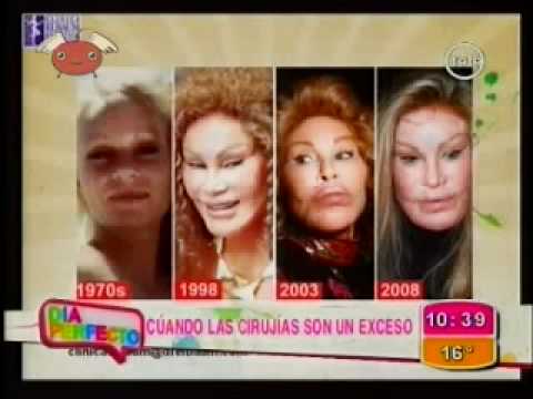 BENDITA TV 238 - SEPARADOS AL NACER