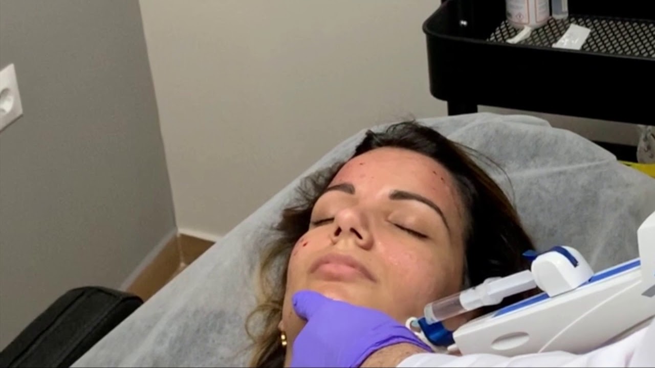 Humberto González Sánchez-18