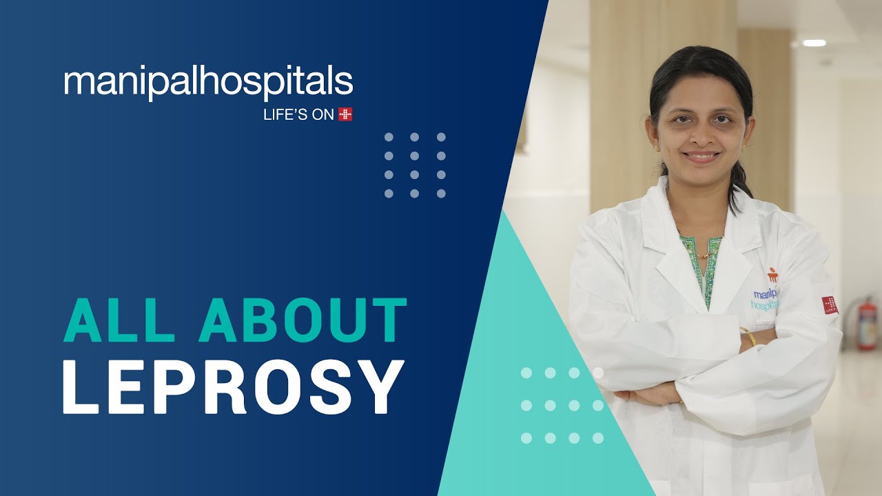 Cause, spread, signs, treatment and prevention of Leprosy | Manipal Hospitals India
