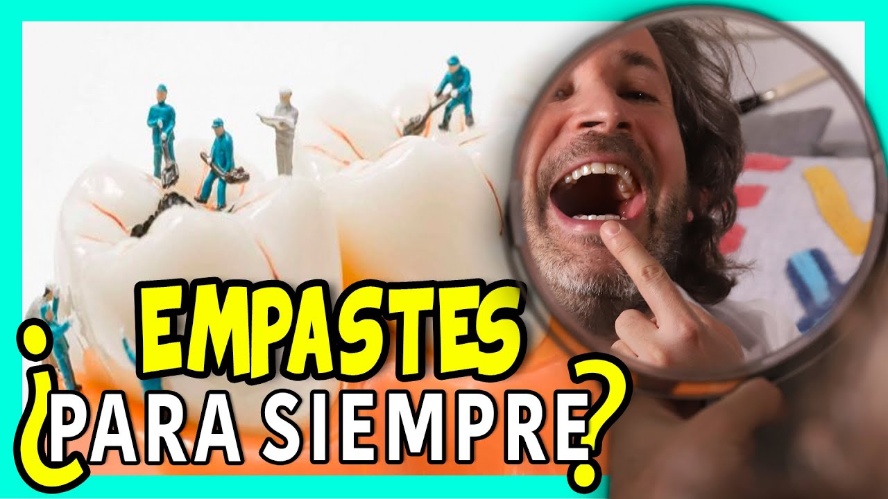 ¿Cuanto TIEMPO dura un 𝙀𝙈𝙋𝘼𝙎𝙏𝙀 𝙙𝙚𝙣𝙩𝙖𝙡⚠️CUIDADO tus dientes NO están a SALVO PARA SIEMPRE