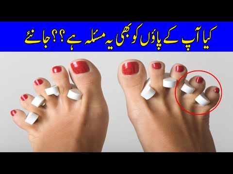 Kya aap ke paon bhi is masla ka shikaar hain?? janiye urdu discovery pr iska hal