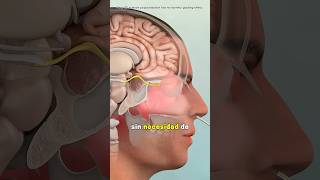 3D Animation of Sinusitis Surgery #Health #Medical #Sinusitis #Treatment #3d