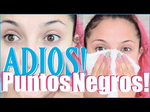 ¡Cómo eliminar puntos negros!