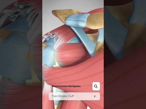 Guess The Spine Injury And Procedure Challenge