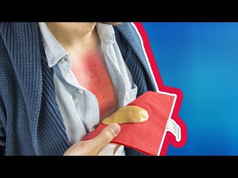 Nervenrückenschmerzen Wie man Kletten an Schmerzen Gelenke verwenden