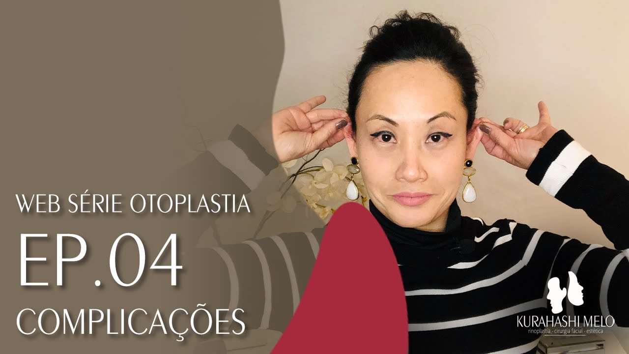 Web série Otoplastia | Ep04 | Complicações | Dra. Andreia Kurahashi Melo