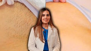 Experta revela la verdad de la depilación láser