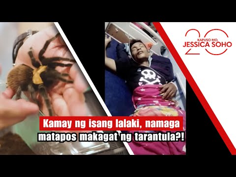Kamay ng isang lalaki, namaga matapos makagat ng tarantula?! | Kapuso Mo, Jessica Soho