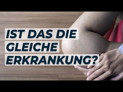 Zusammenhang zwischen HÄMORRHOIDEN und KRAMPFADERN? Dr. Eduard Karsten klärt auf
