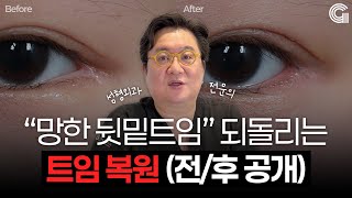망한 뒷밑트임 되돌리는 