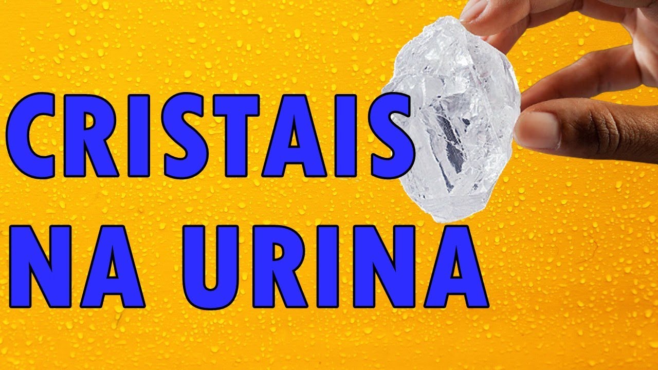 CRISTAL na URINA: NÃO é PEDRA e Não DÓI !