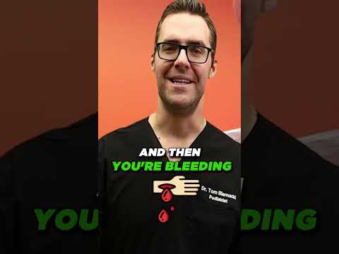 Best Wound Care Centers in Michigan Skin Diabetic Foot Ulcers