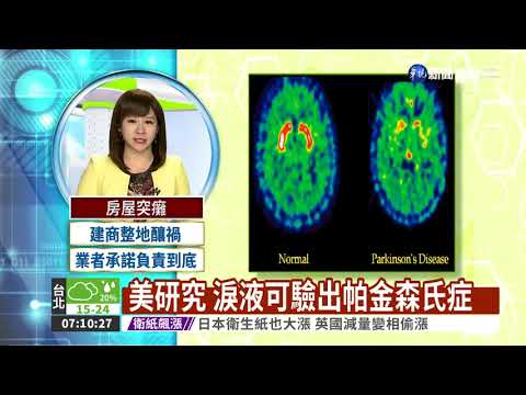 美研究 淚液可驗出帕金森氏症