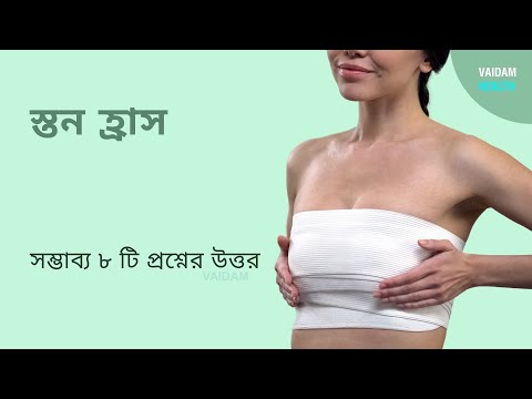 স্তন হ্রাস -৮ টি প্রায়শই জিজ্ঞাসিত প্রশ্ন