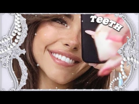 Perfect Teeth || Paid Request