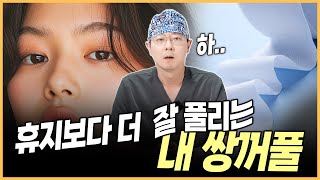 내 쌍꺼풀 특) 휴지보다 더 잘 풀림 (feat. 원인과 해결 방법)
