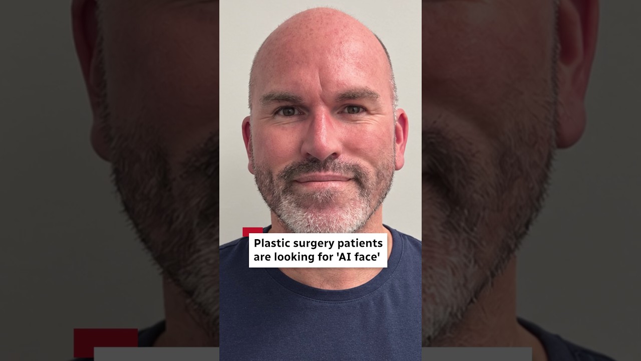 Video: Patients bring AI-generated 'perfect' faces to plastic surgeons