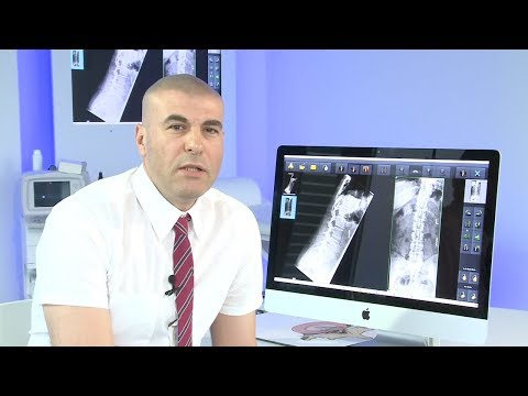 Osteochondrose der Halswirbelsäule und Schwangerschaft Als arthritische Beingelenke zu behandeln