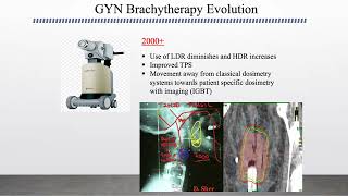 HDR Gynecologic Applicators