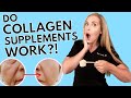 Do Collagen Supplements Work?! |Anti-aging Skincare PART 1