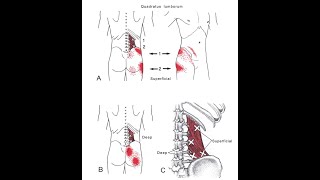 Quadratus Lumborum (QL) Muscle | Low Back Pain & Physiotherapy Guide