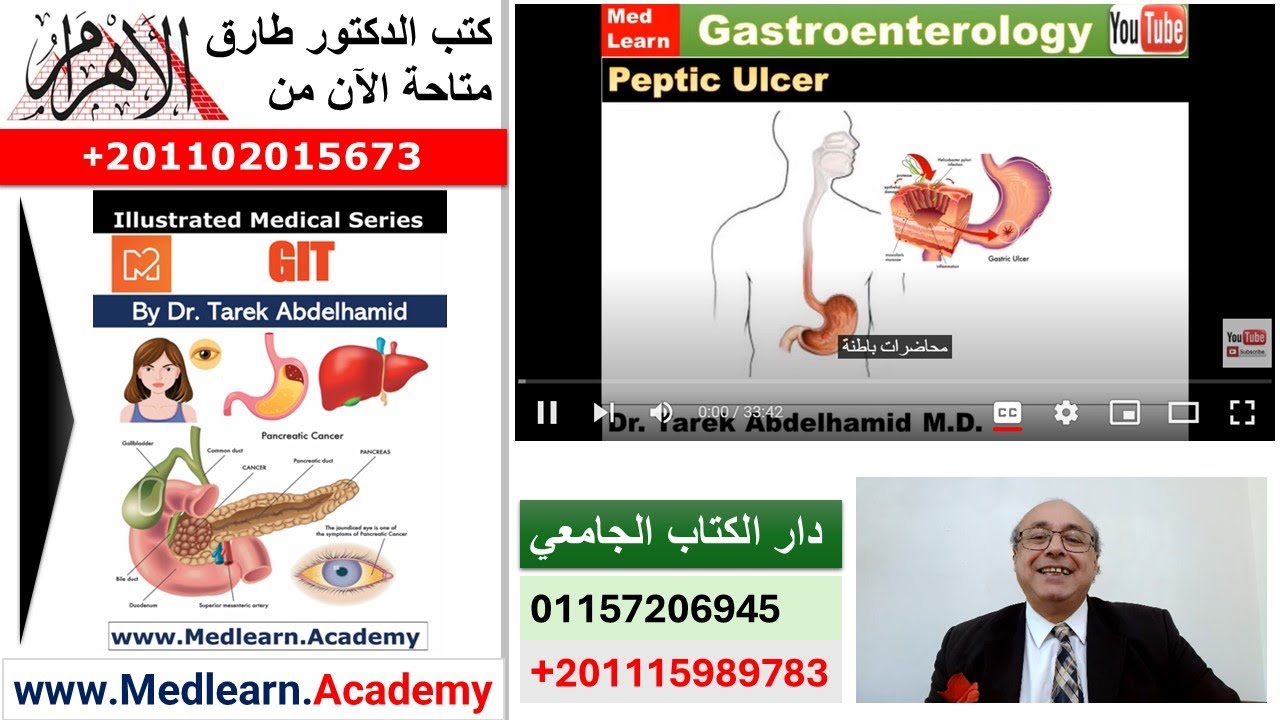 Peptic Ulcer (PUD)  #internal_medicine #cme  #ecg #محاضرات_باطنة #medical #usmle  #medicalstudent