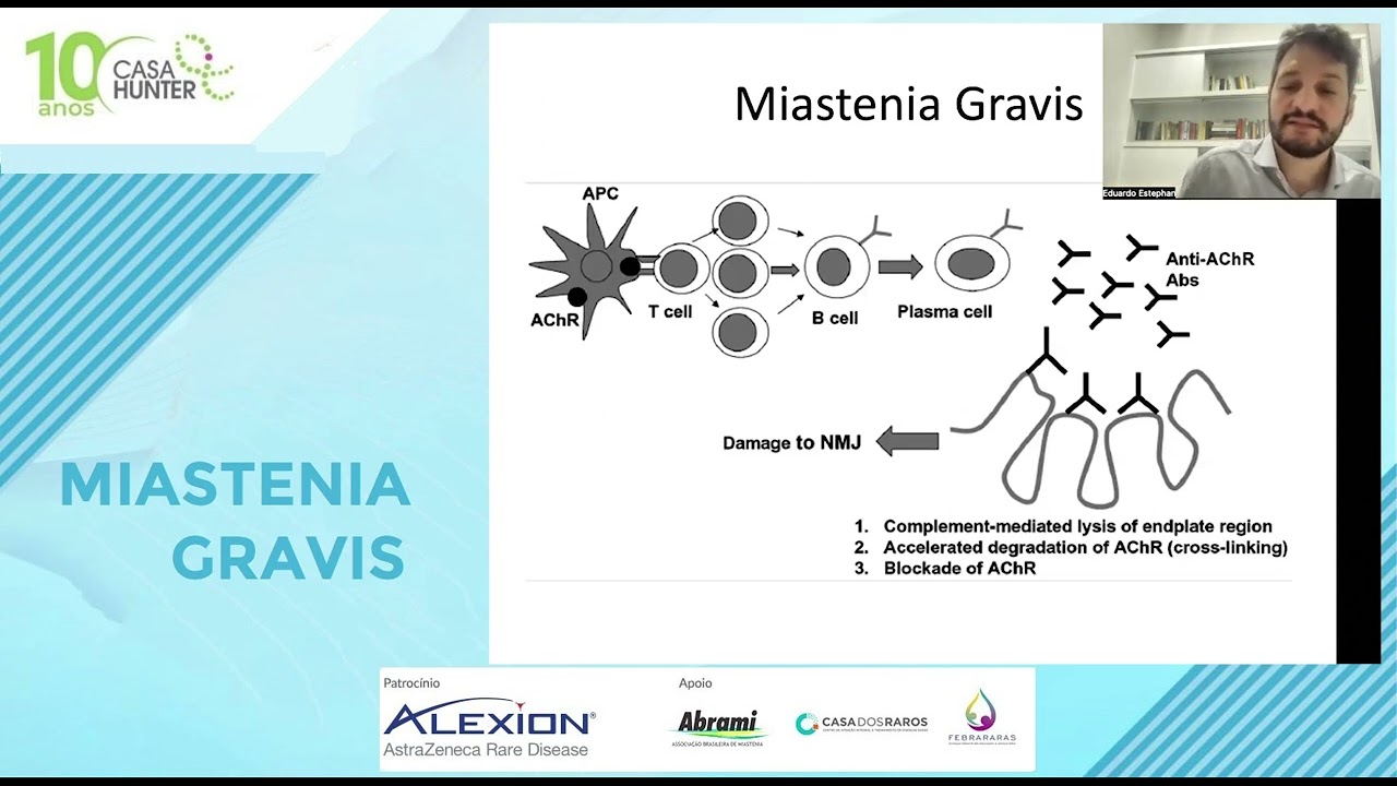 Videoaula Miastenia Gravis