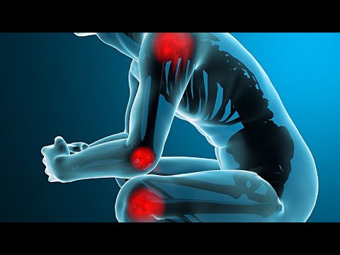 Boli ale articulatiilor genunchiului