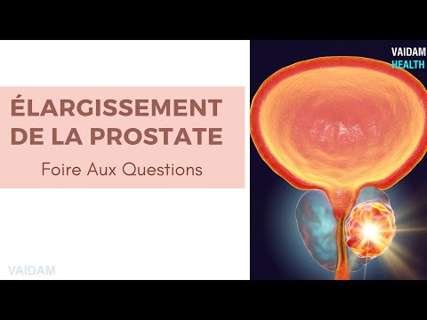 Élargissement de la prostate