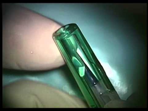 DMEK with medicel part1