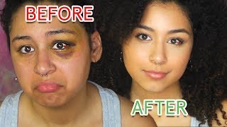 How To Cover A Black Eye With Drugstore Make Up | Not Cakey