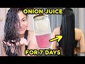 I Tried ONION JUICE On My Hair FOR 7 DAYS THIS HAPPENED Before After Results