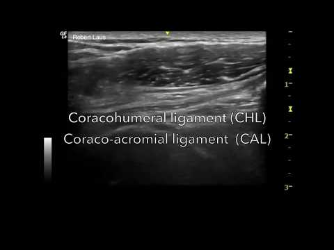 Coraco-humeral ligament & Coraco-acromial ligament. Dynamic ultrasound.