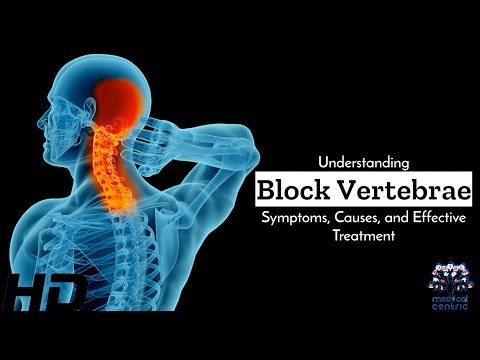 Effects of Cannabis on your body