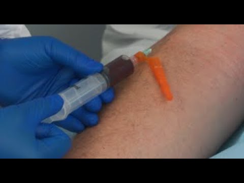 BACT/ALERT Blood Culture Collection: Needle and Syringe draw method