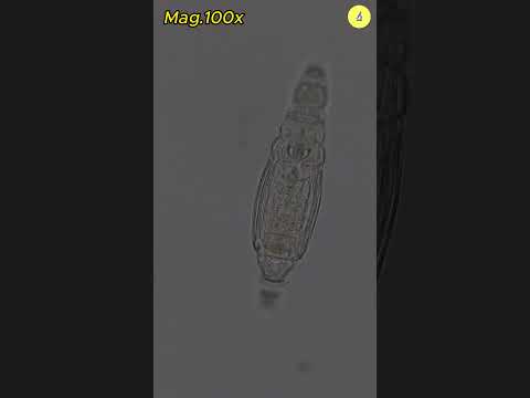 Protozoa under the microscope | TULO - Microscope #shorts #microscope #protozoa