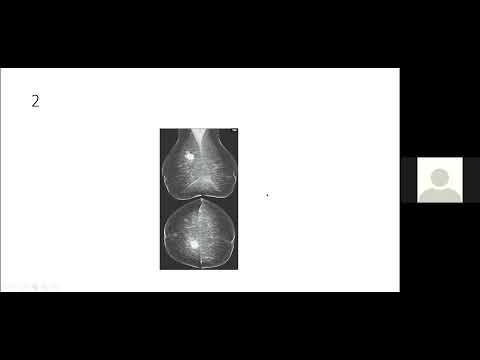 TEAM FRCR 2B GU & Mammogram Viva practice