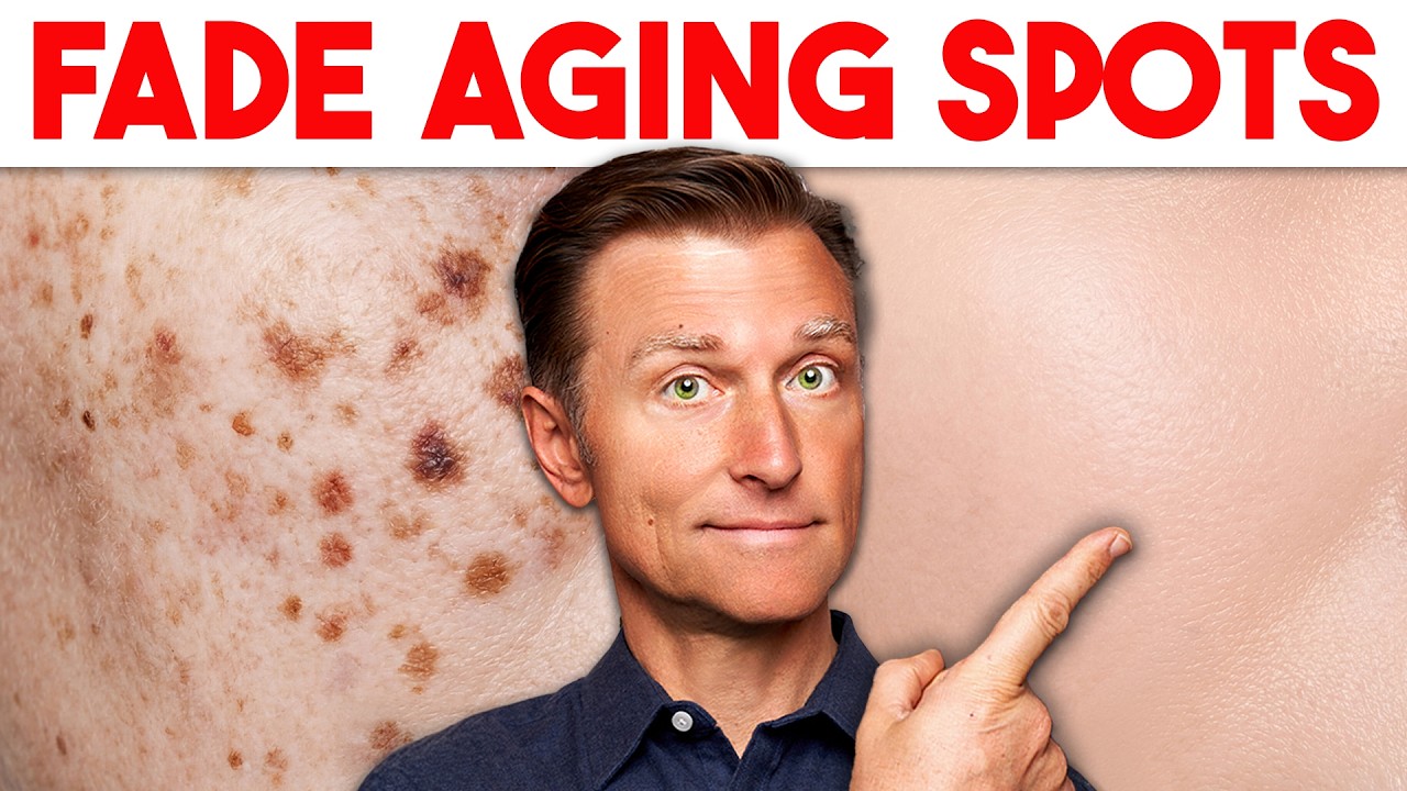 Age Spots Are NOT Normal Aging