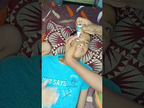 eye drops  #shyamstatus #funny #shyam #comedyfilms drops
