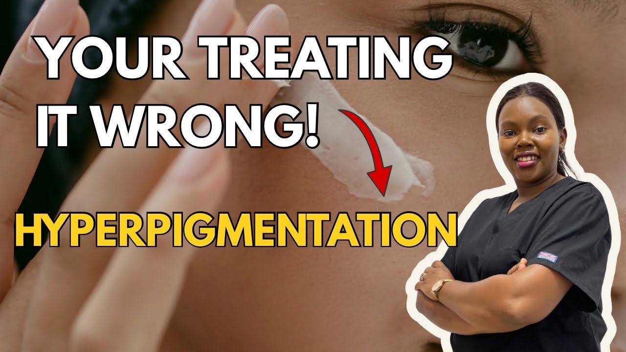 Why Your Dark Spots Aren’t Fading | PART 3 | HYPERPIGMENTATION SERIES 