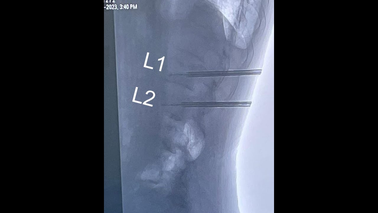 Gerson Reyes Rodríguez-81