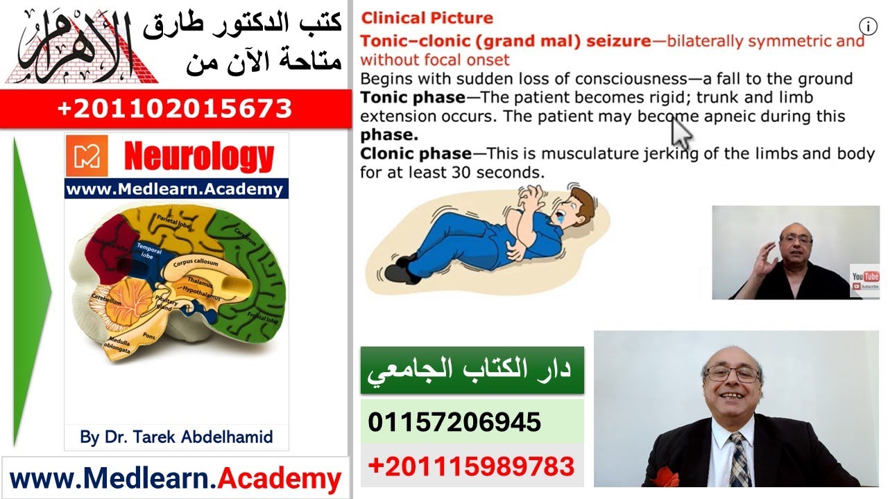 Epilepsy (2) #internal_medicine #cme #medicaleducation #محاضرات_باطنة #medicalcollege