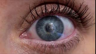 Kemba - Already (Opalite Remix)