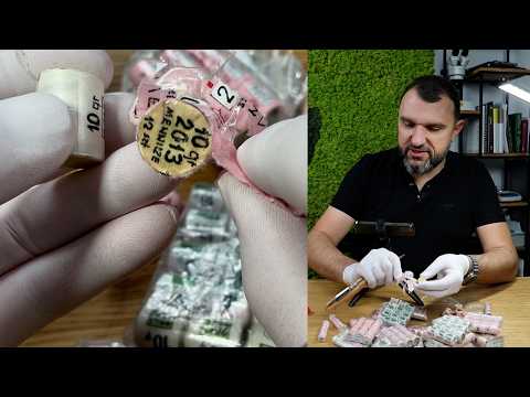 He ruined his coins by... over-caring? An unusual case of a collector.