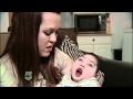 Baby born without brain brain turns 2 