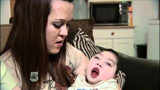 Baby born without brain brain turns 2