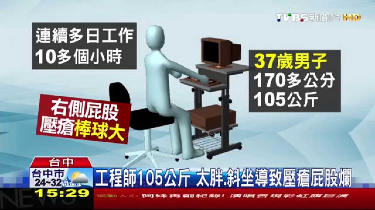 工程師加班久坐10小時 屁股壓瘡棒球大